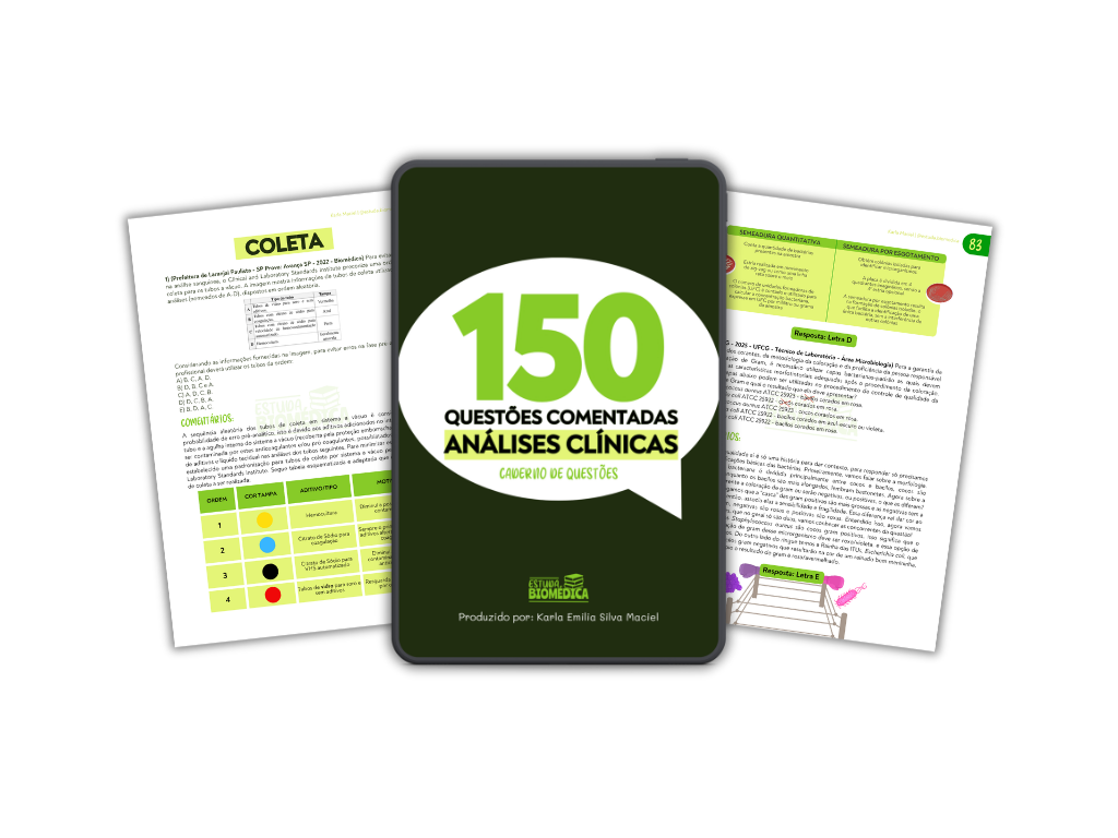 150 Questões comentadas, e-book