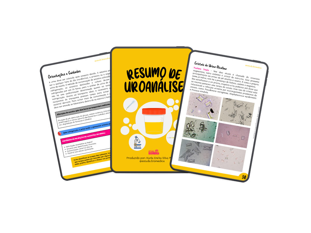 Resumo de Uroanálise, e-book